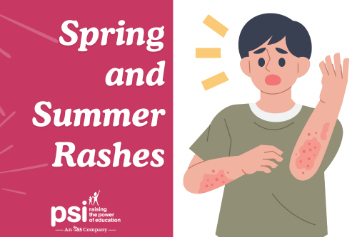 Spring and Summer Rashes