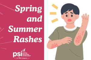 Spring and Summer Rashes